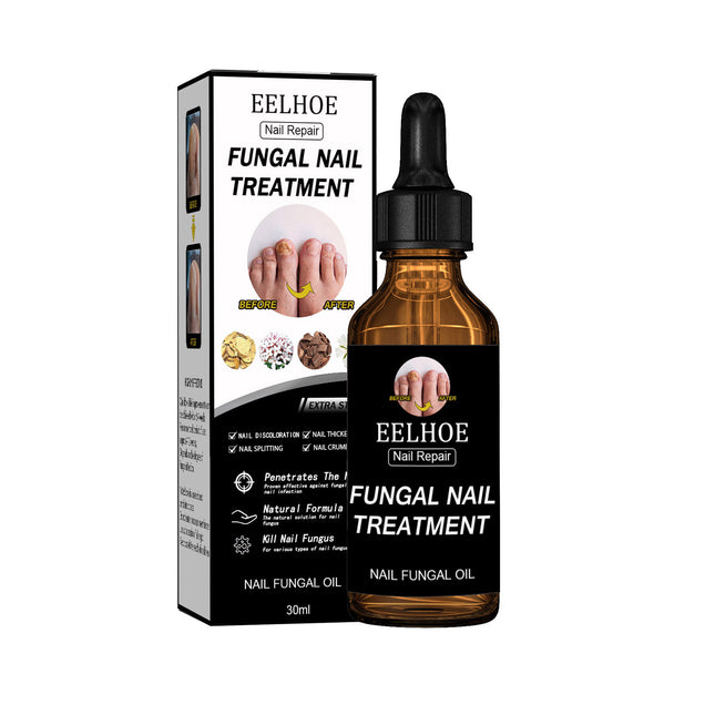 EELHOE Nail Repair Liquid Thickens, brightens nails, removes onychomycosis and dead skin, repairs and moisturizes nails, and is a nourishing nail care liquid